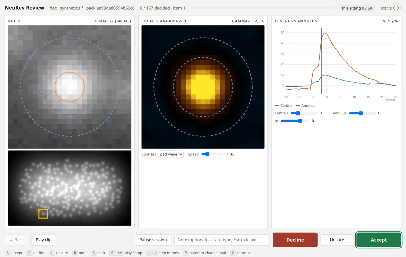 NeuRev Review showing one candidate: the raw clip with centre and annulus circles, the same clip after local standardization glowing at the centre, and a trace where the centre rises far above its surroundings, with Decline, Unsure and Accept buttons.